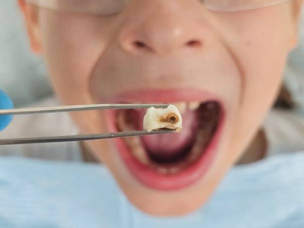 Best Walk-In Emergency Dental Services in Heyville, AL
